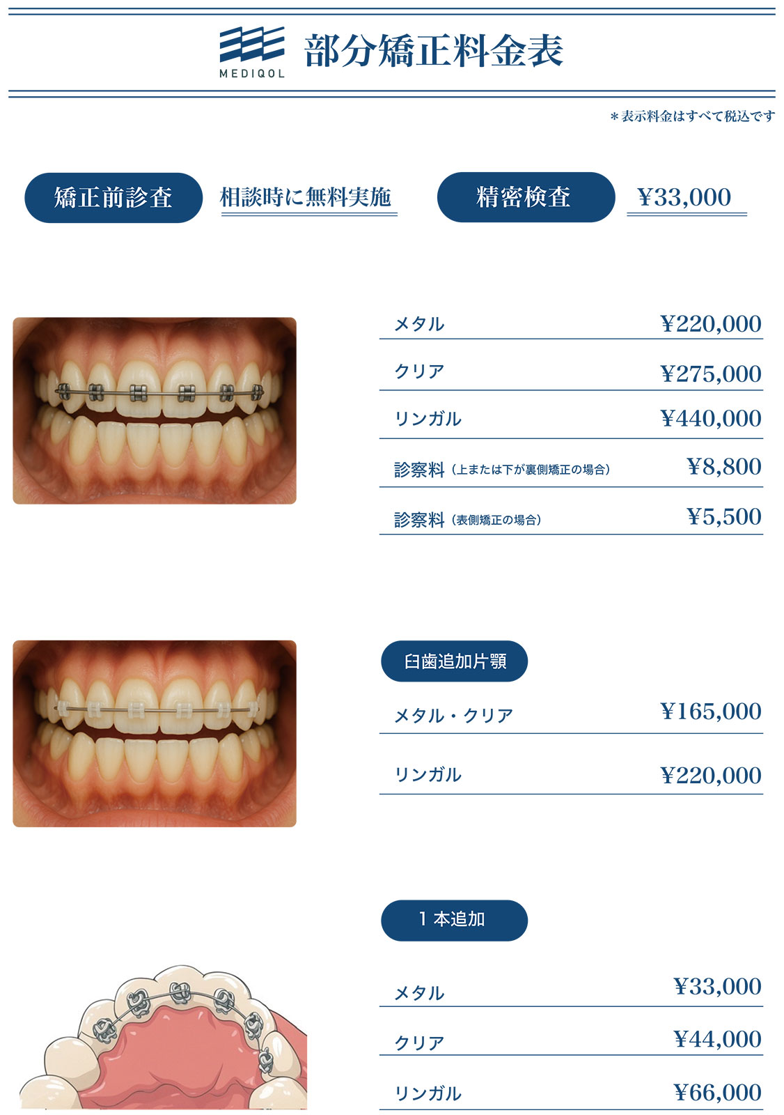 部分矯正料金表